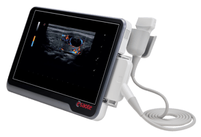 Esaote-x1-Hubspot-1